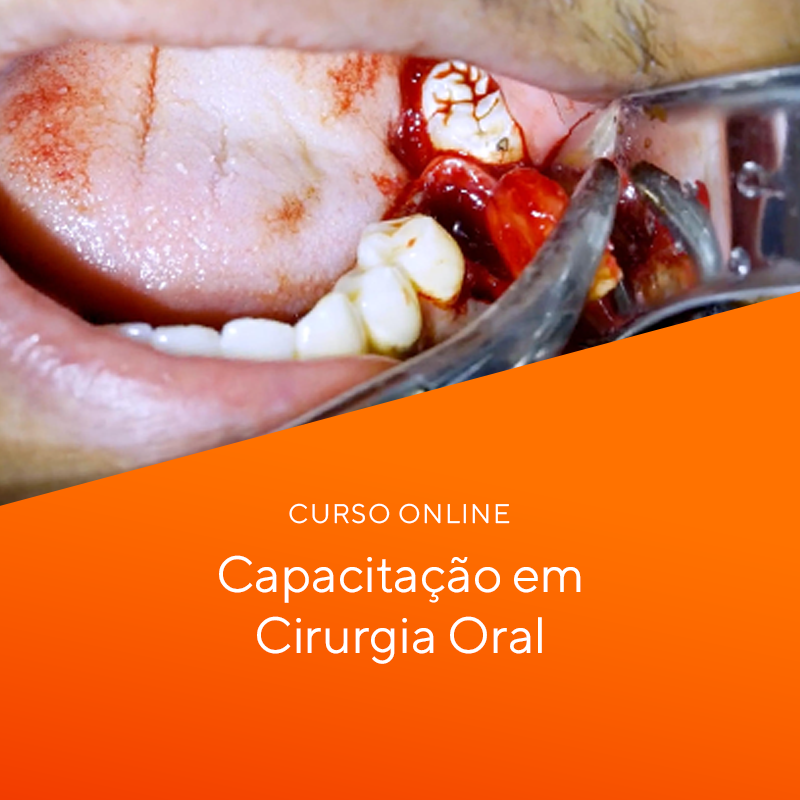 Curso Online de Cirurgia Oral